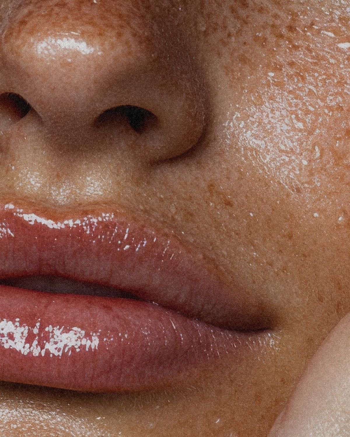 A board-certified nurse practitioner's guide to choosing a safe lip filler injector — credentials, complication management, ultrasound & the questions to ask.
